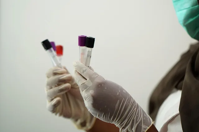 laboratory, test tubes, medical staff, researcher, coronavirus, pandemic, lab test, blood sample, blood specimen, test tubes, medical staff, medical staff, medical staff, medical staff, medical staff, lab test, blood sample, blood sample, blood sample, blood sample, blood sample. The primary market research best practices worth adopting first